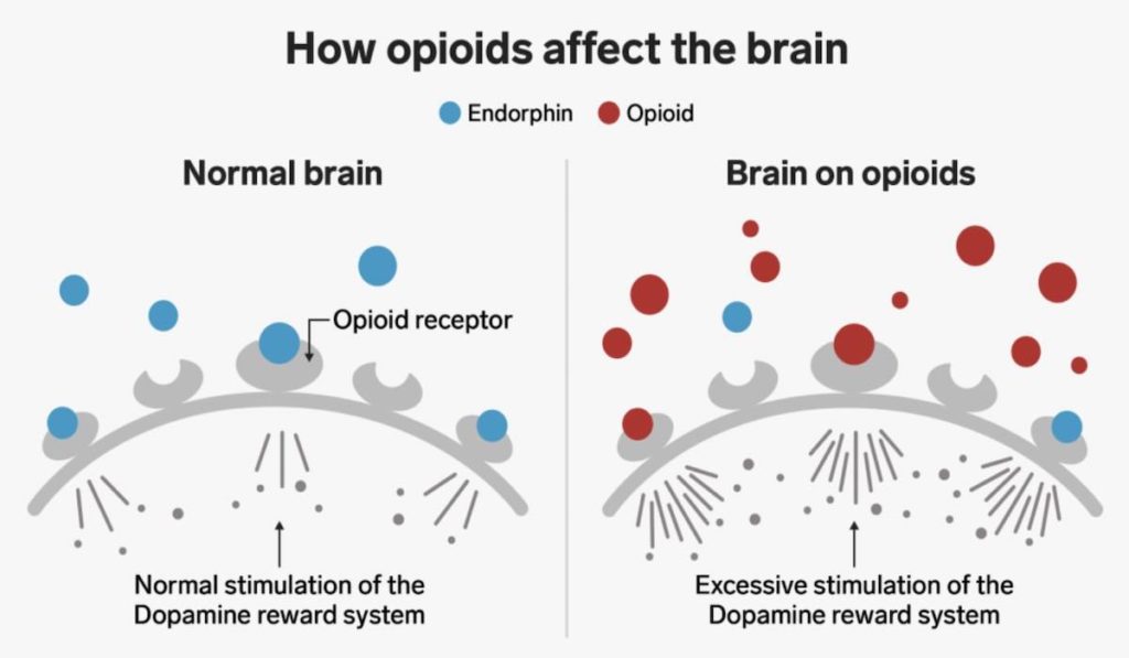 Opioids Effectiveness