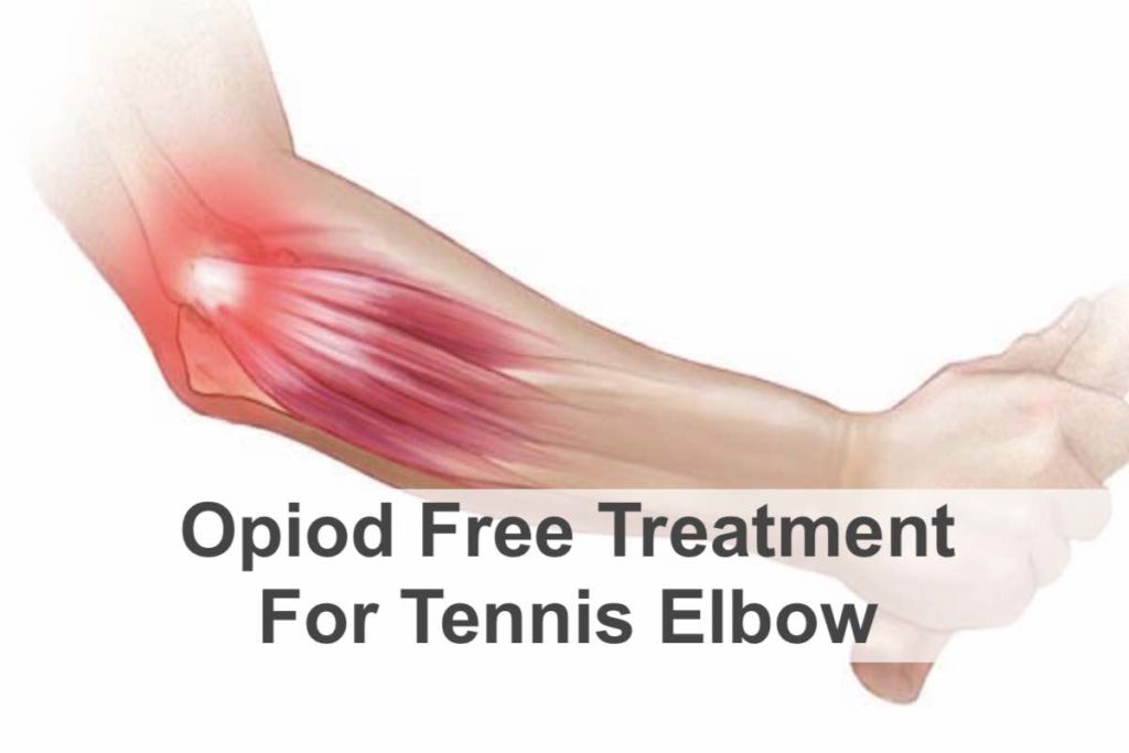 Tennis Elbow Treatment NYC